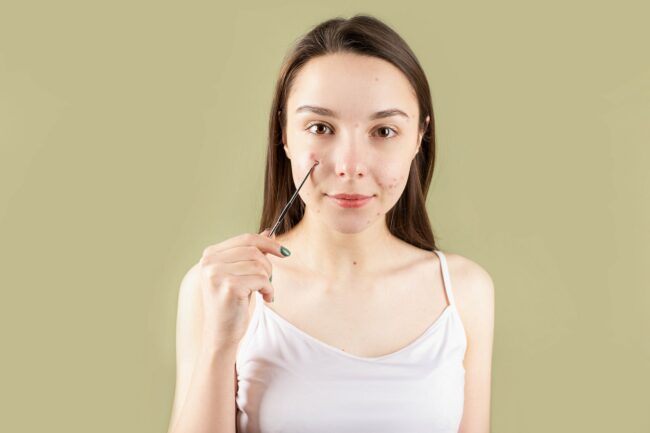 middlepathspa_acne problem