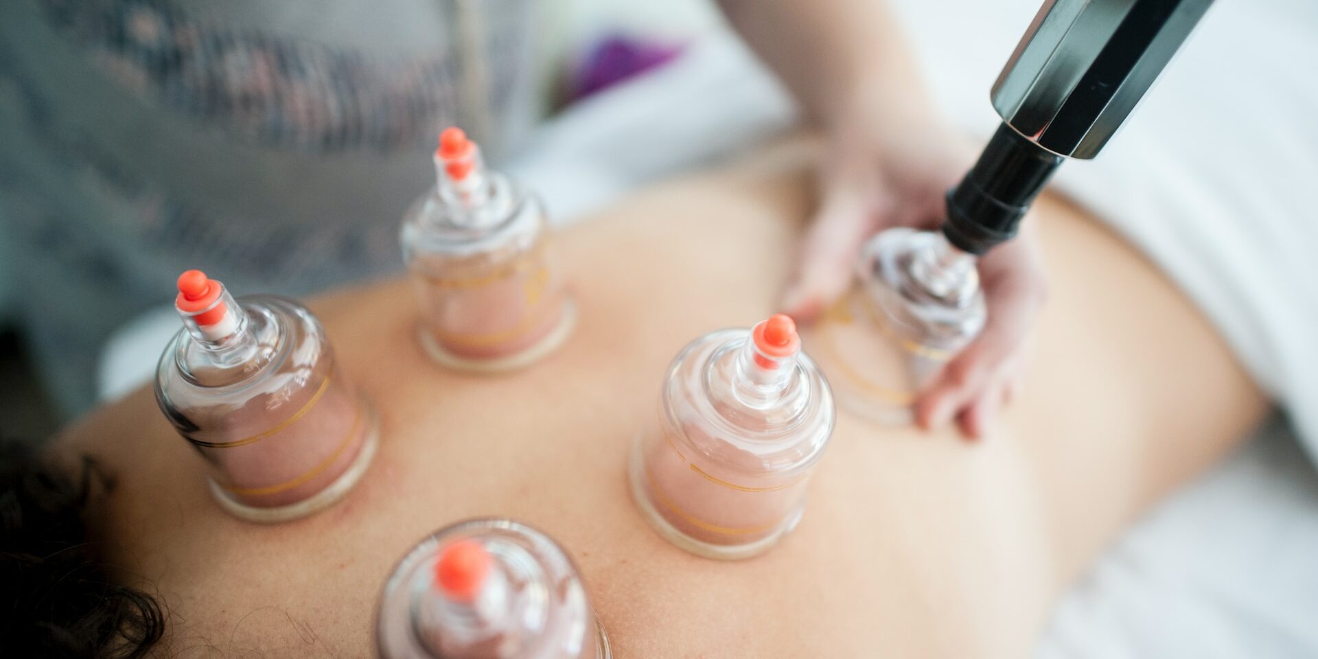 middlepathspa_cupping therapy is cupping good for you?