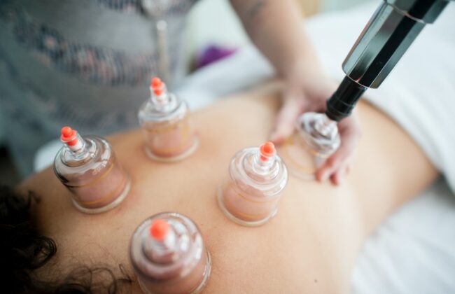 middlepathspa_cupping therapy is cupping good for you?