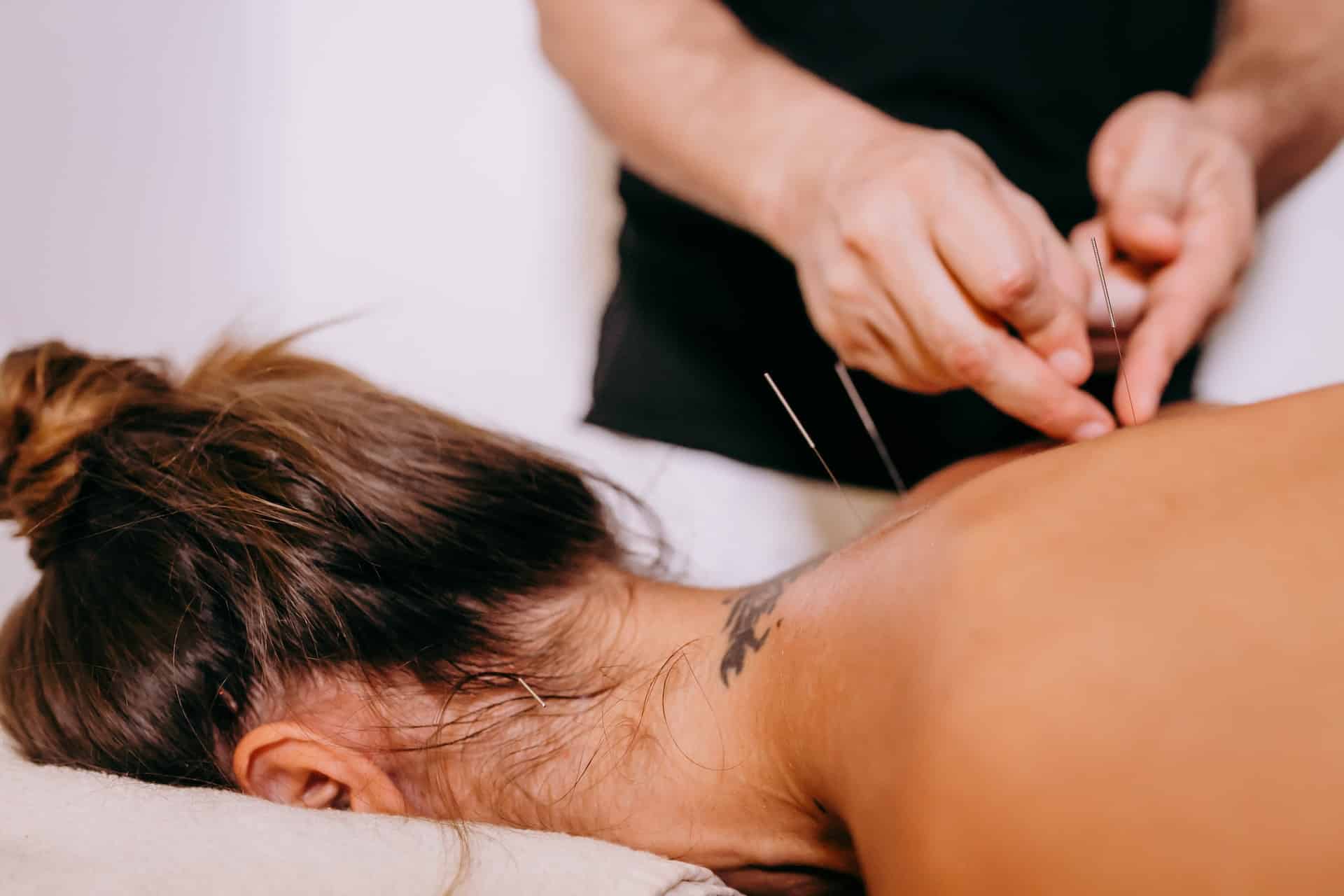 duration of acupuncture