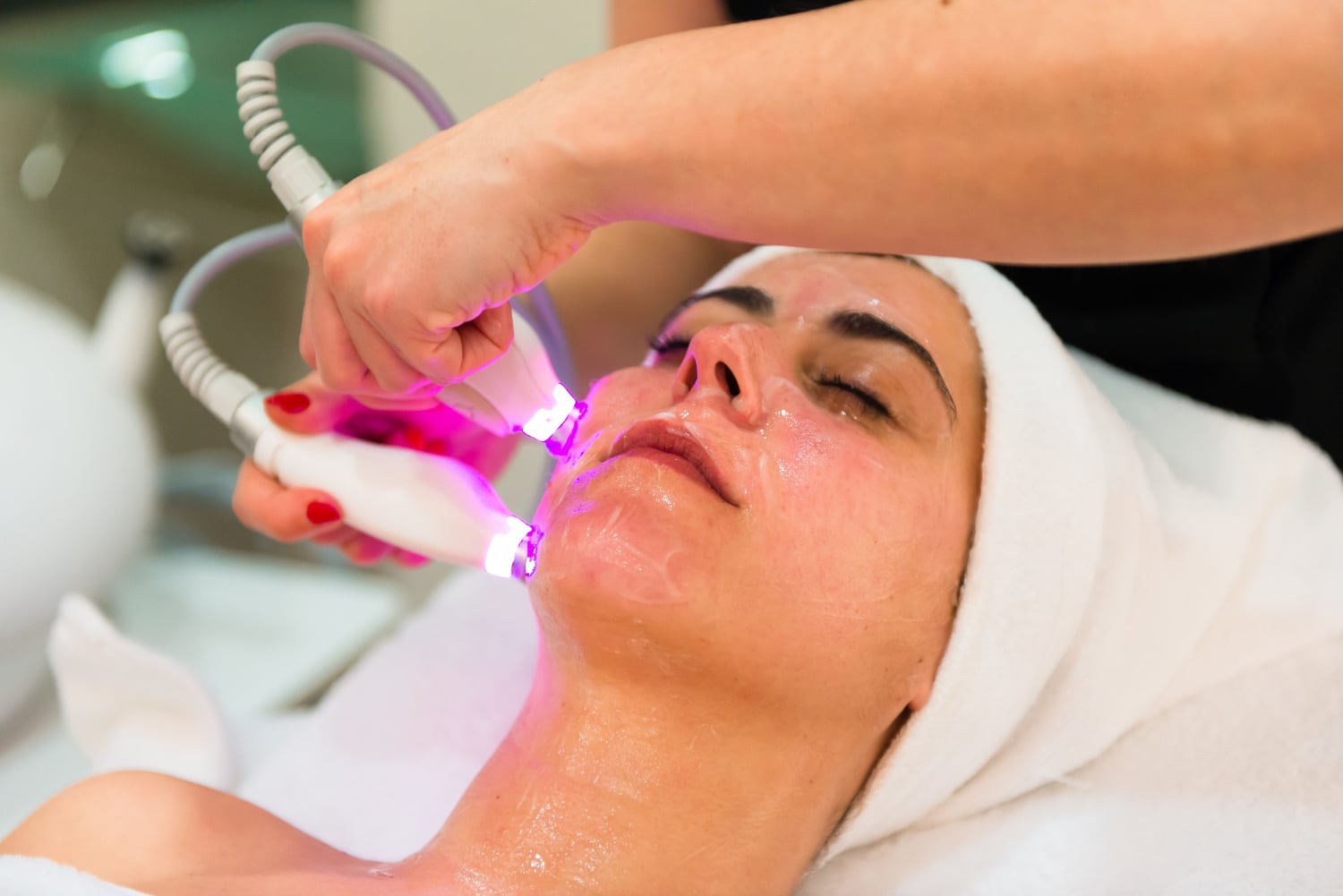 electrolysis the best way to remove facial hair 