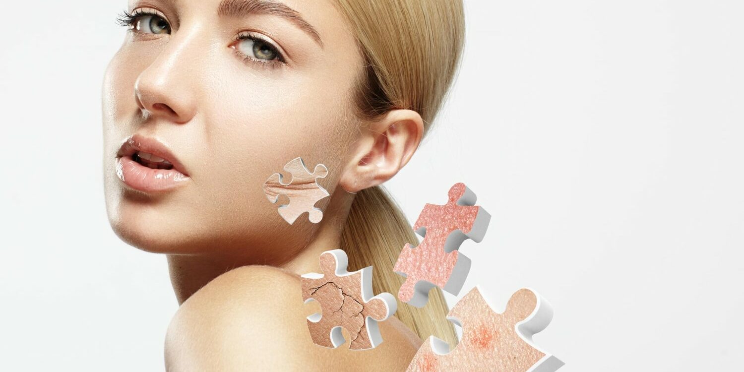 how to repair damaged skin barrier